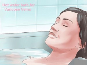 Varicose Veins Treatment with Hot Bath