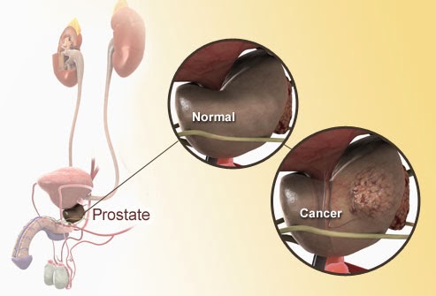 Prostate Diagram, Anatomy and Functions