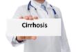 Liver cirrhosis