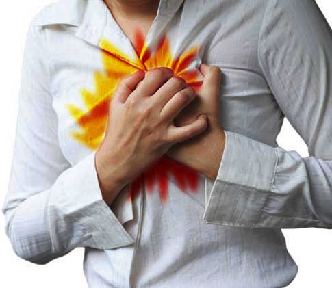 Sign and Symptoms of Acid Reflux