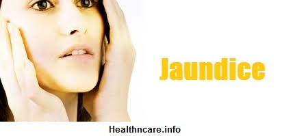 Obstructive Jaundice Symptoms, Causes and Treatment