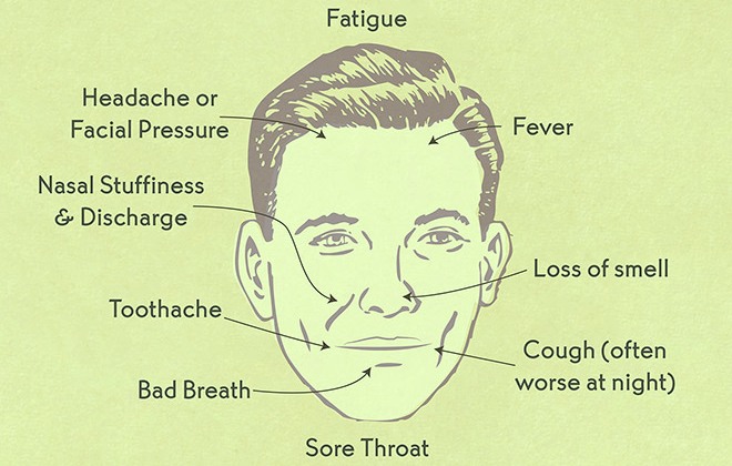 Are Sinus Infections Contagious? Causes and Prevention