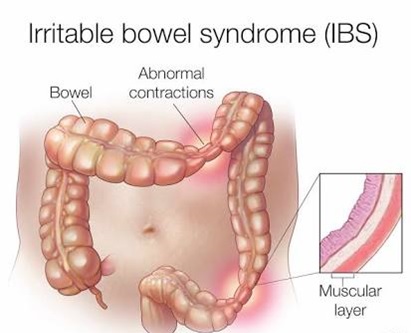 What is the BRAT diet for diarrhea?