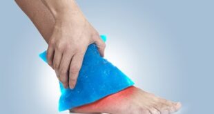 Tarsal Tunnel Syndrome Treatment with Home Remedies