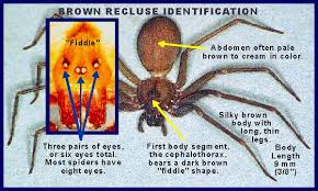 Brown Recluse Spider Bite Symptoms Causes Treatment Hot Sex Picture
