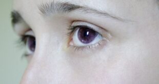 Is Alexandria's Genesis (Purple Eyes Mutation) Real or Fake?