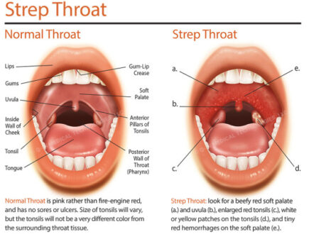 throat symptoms Deep