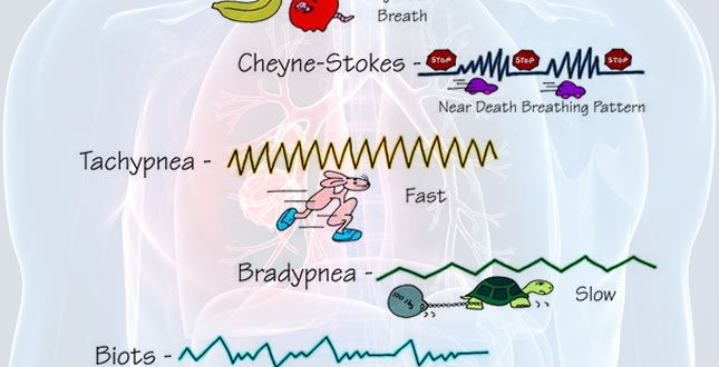 cheyne-stokes-breathing-and-kussmaul-respirations-differences