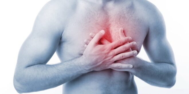 Substernal Chest Pain Meaning In English