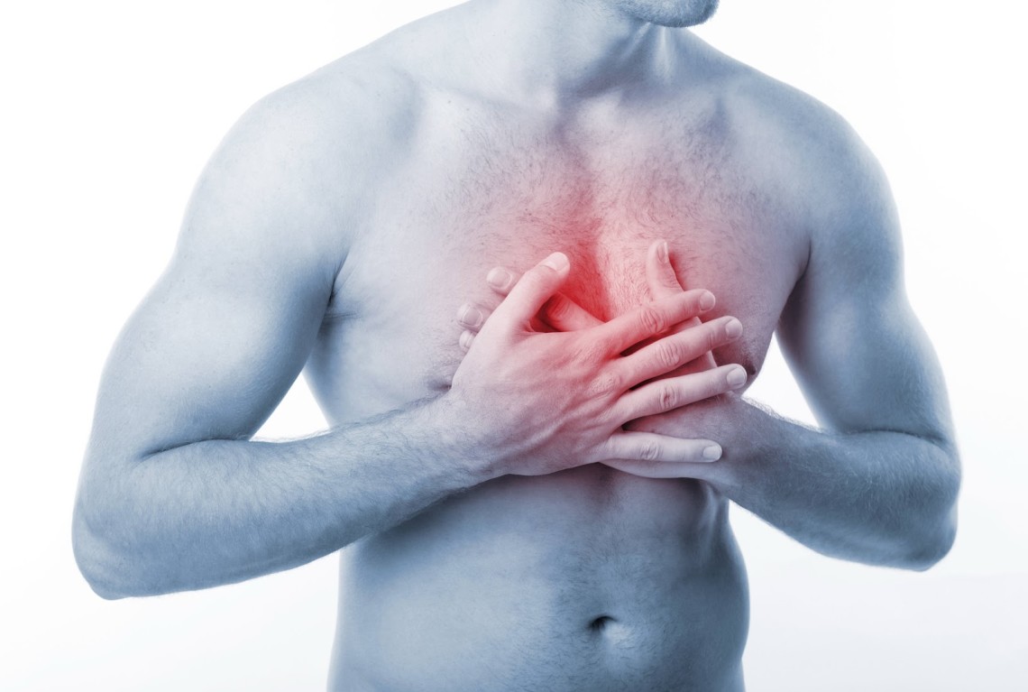 Atrial Fibrillation Chest Discomfort