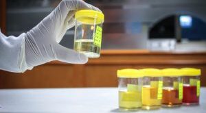 What is Sterile Pyuria in Urine Test Definition and Findings