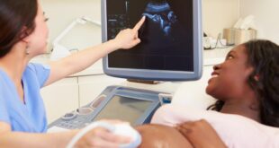 Fetus Papyraceus Definition, Symptoms, Causes, Treatment