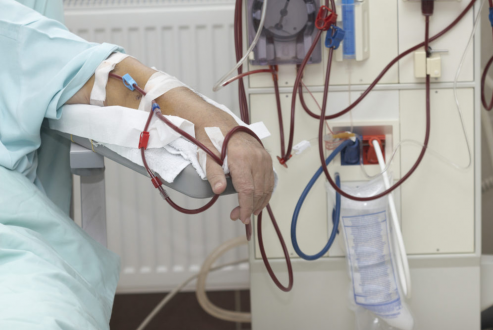 Pauci Immune Glomerular Nephritis Symptoms, Causes, Diagnosis, Treatment