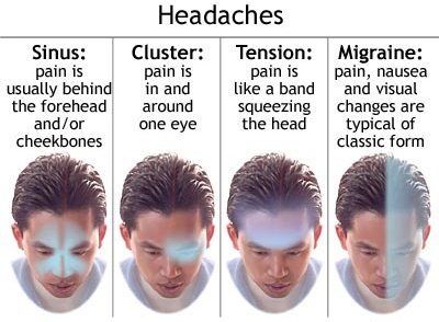 Headaches Types: Migraine, Tension, Cluster, Sinus