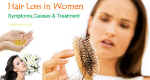 Hair Loss in Women Treatment, Causes, Symptoms, Research