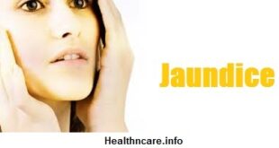 Obstructive Jaundice Symptoms, Causes and Treatment