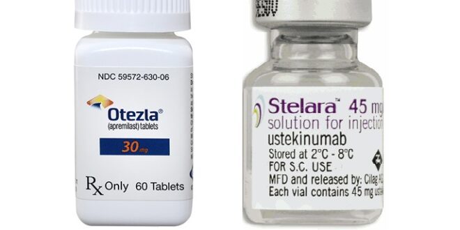 otezla-vs-stelara-psoriatic-arthritis-side-effects-cost-dosage-review