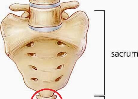 tailbone causes