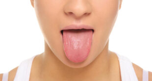 Swollen/Inflamed Taste Buds on Tongue Causes and Treatment