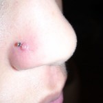 Nose Piercing Bump