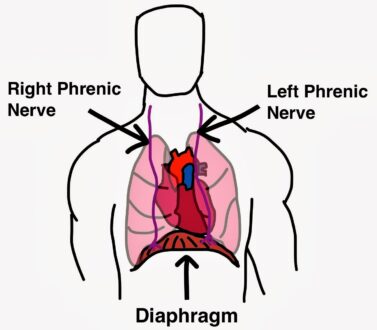 Causes of Diaphragm Spasm