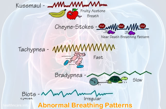 Abnormal Respiration Patterns: Cheyne Stokes Breathing, Kussmaul, Biots Differences