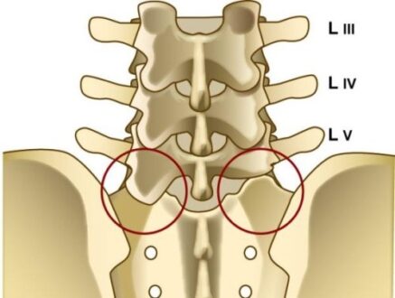 Sacralization of L5 - Definition, Symptoms, Treatment