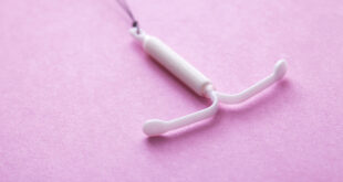 Mirena IUD Crash, Weight Gain and Removal Side effects