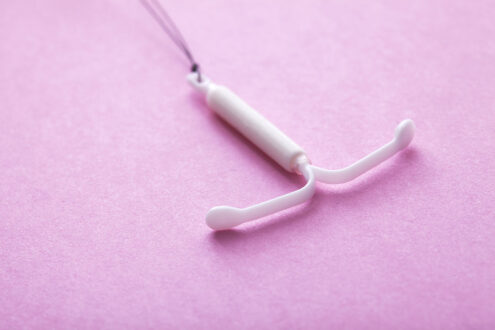 Mirena IUD Crash, Weight Gain and Removal Side effects