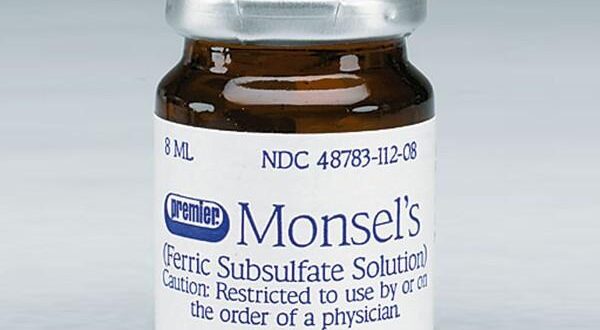 Monsel Solution Uses, Side Effects, Mechanism, Preparation