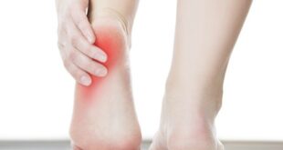 Traction Apophysitis of Knee, Heel, Hip, Elbow, Foot