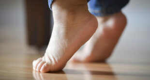 Idiopathic Toe Walking Treatment, Excercises, Physical Therapy, Shoes