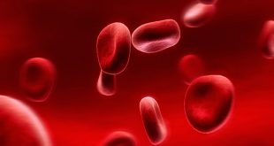 Sticky Platelet Syndrome Symptoms, Causes, Treatment