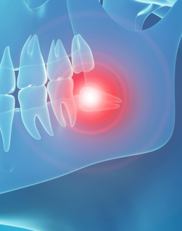 Costen Syndrome Symptoms, Causes, Treatment