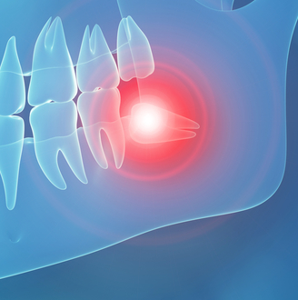 Costen Syndrome Symptoms, Causes, Treatment